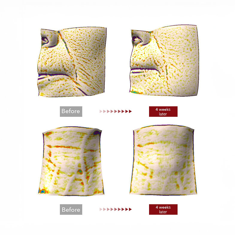 Collagen Madeca Cream Time Reverse Advanced Fast Absorbing Nourishing Hydrates Firms Reduces Wrinkles Korean Skin Care Centella